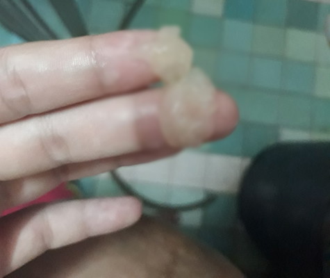 มีมูกขาวๆเหนียวๆออกจากช่องคลอด