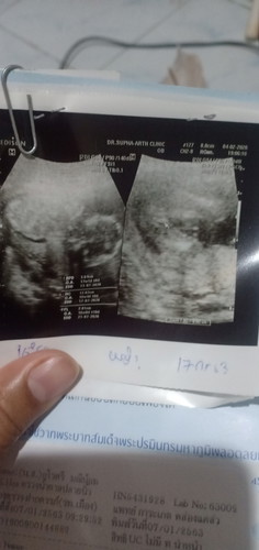 ผ.ญใช่ไหมค่ะ