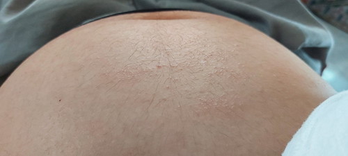 6 months