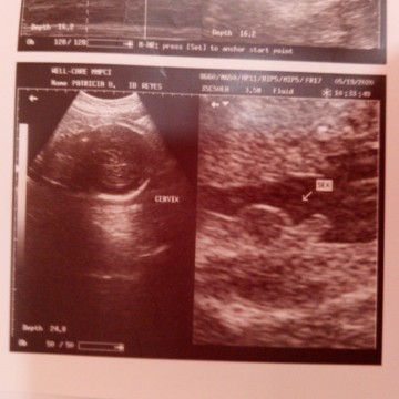 Gender ni baby