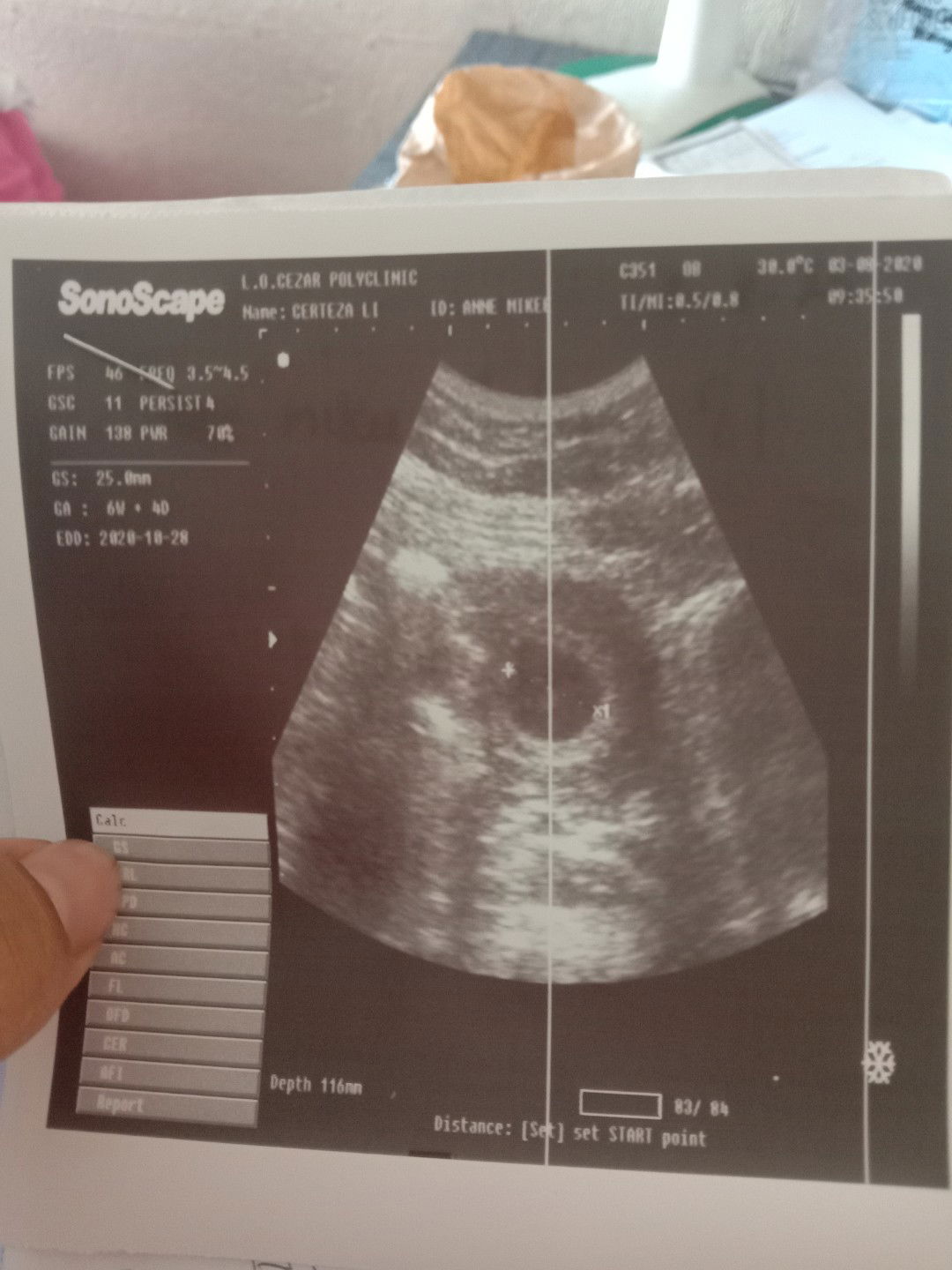 Bakit po kaya ganun? P answer po.