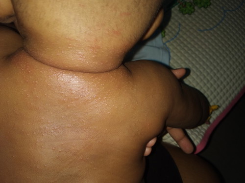 sensentive baby 4 months