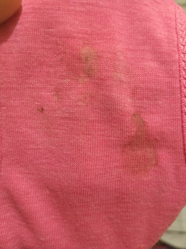 bercak pada 6minggu kehamilan..