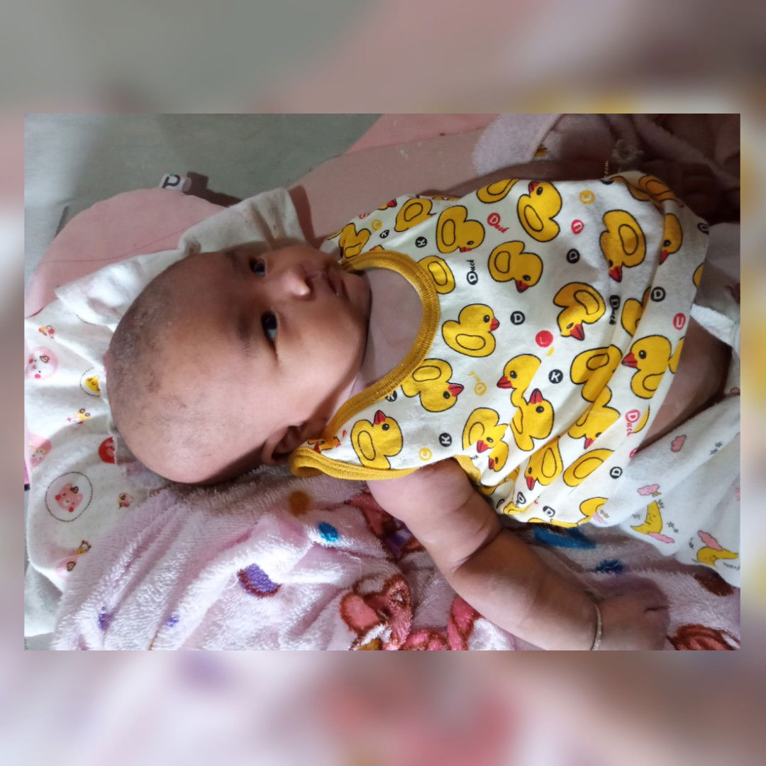 โกนผมไฟ