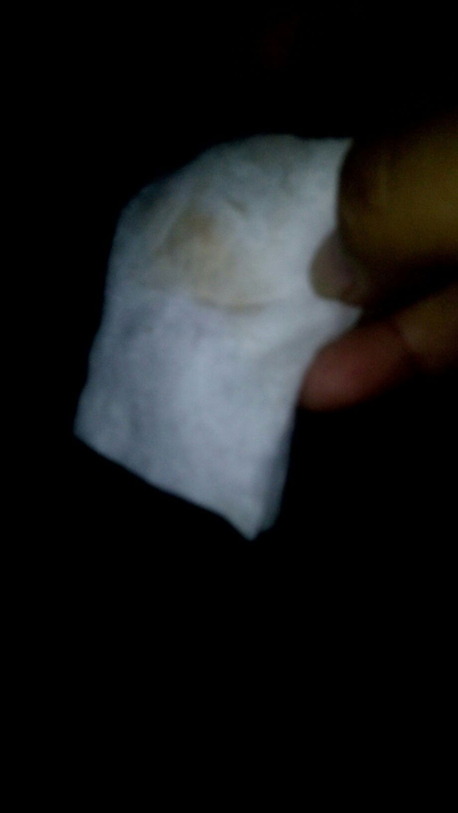 keputihan atau flek?