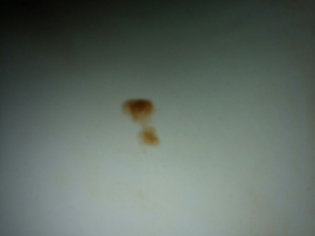 keluar lendir coklat kemerah merahan