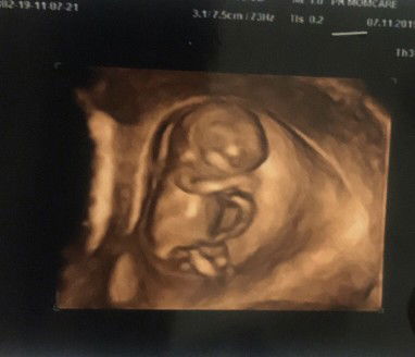 Thịt Gà profile icon