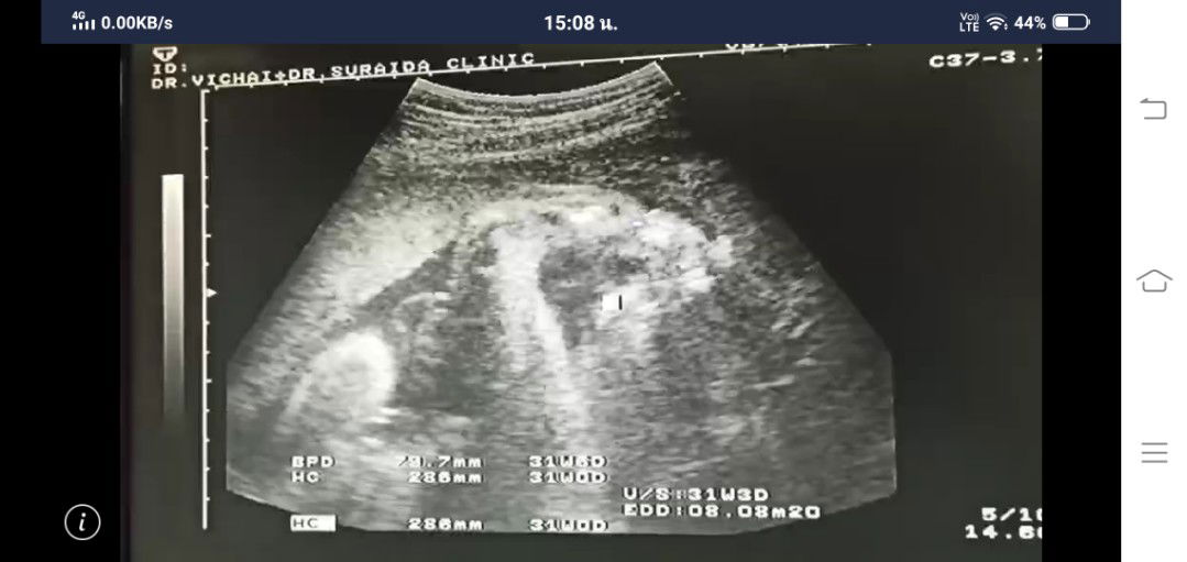 บ้านไหนนอนแบบนี้บ้างค่ะ