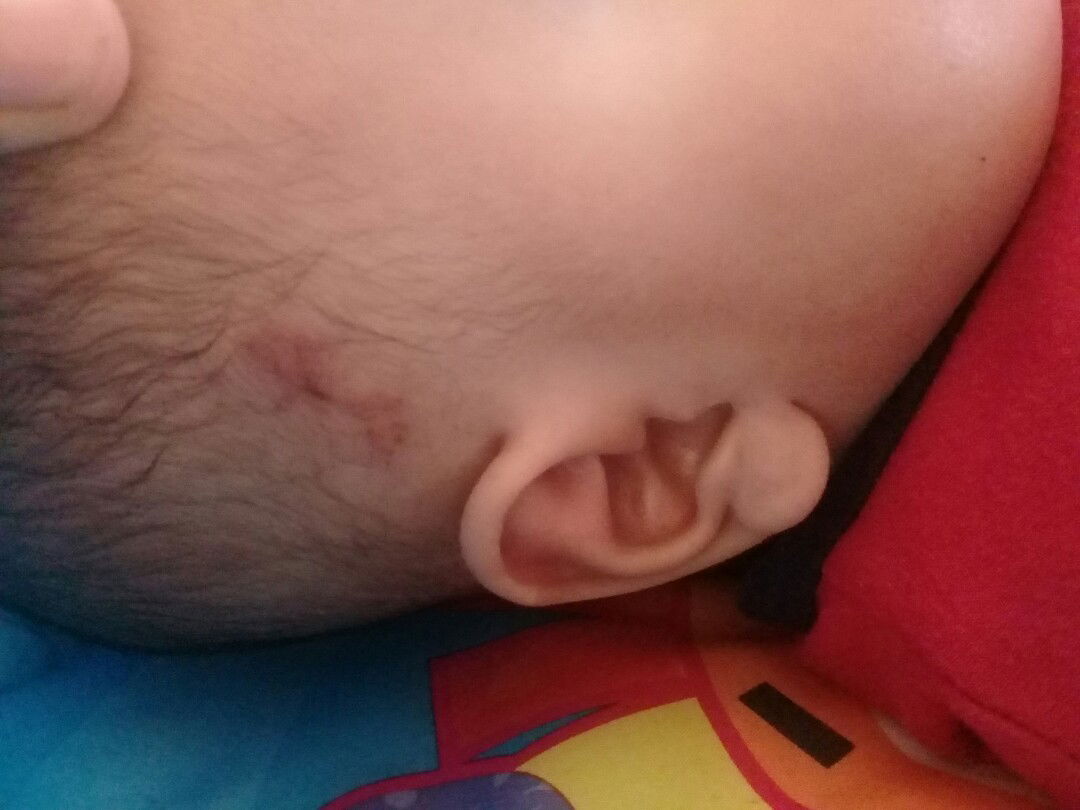 kulit baby