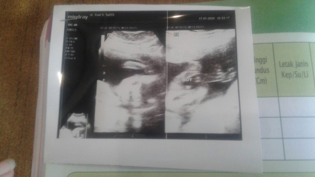 alhamdulillah ternyata single?