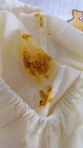 ถ้าลูกถ่ายแล้วมีเลือดออกมาด้วยเป็นอะไรมั๊ยค่ะ