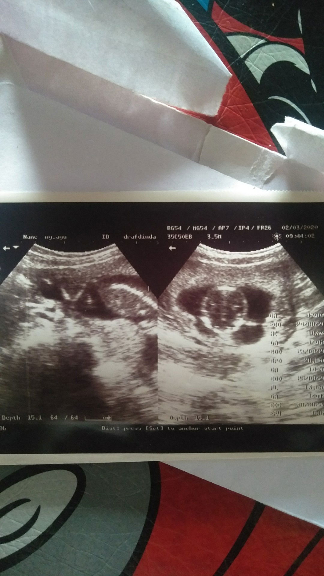 Usia kandungan 16 minggu