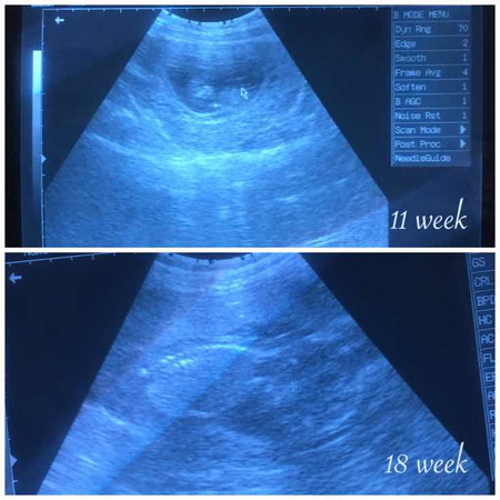 อิแม่ลุ้น?