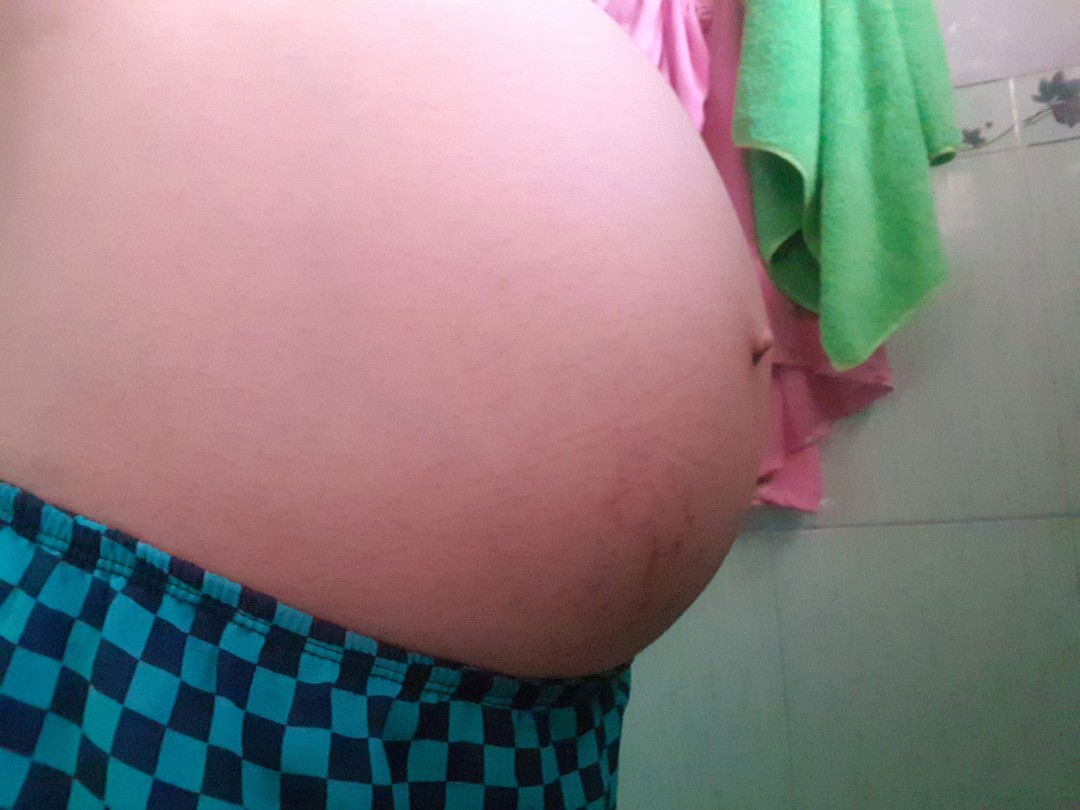 bụng tuộc ch ạ