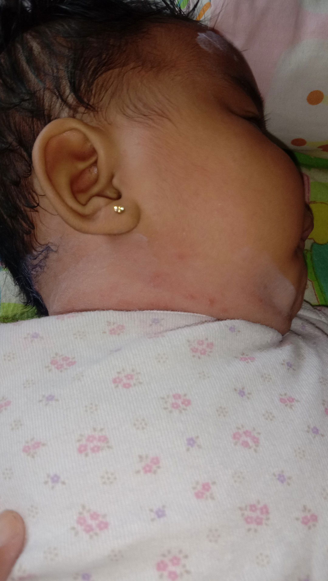 gatal d leher anak ku ...