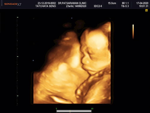 ซาวด์4มิติ