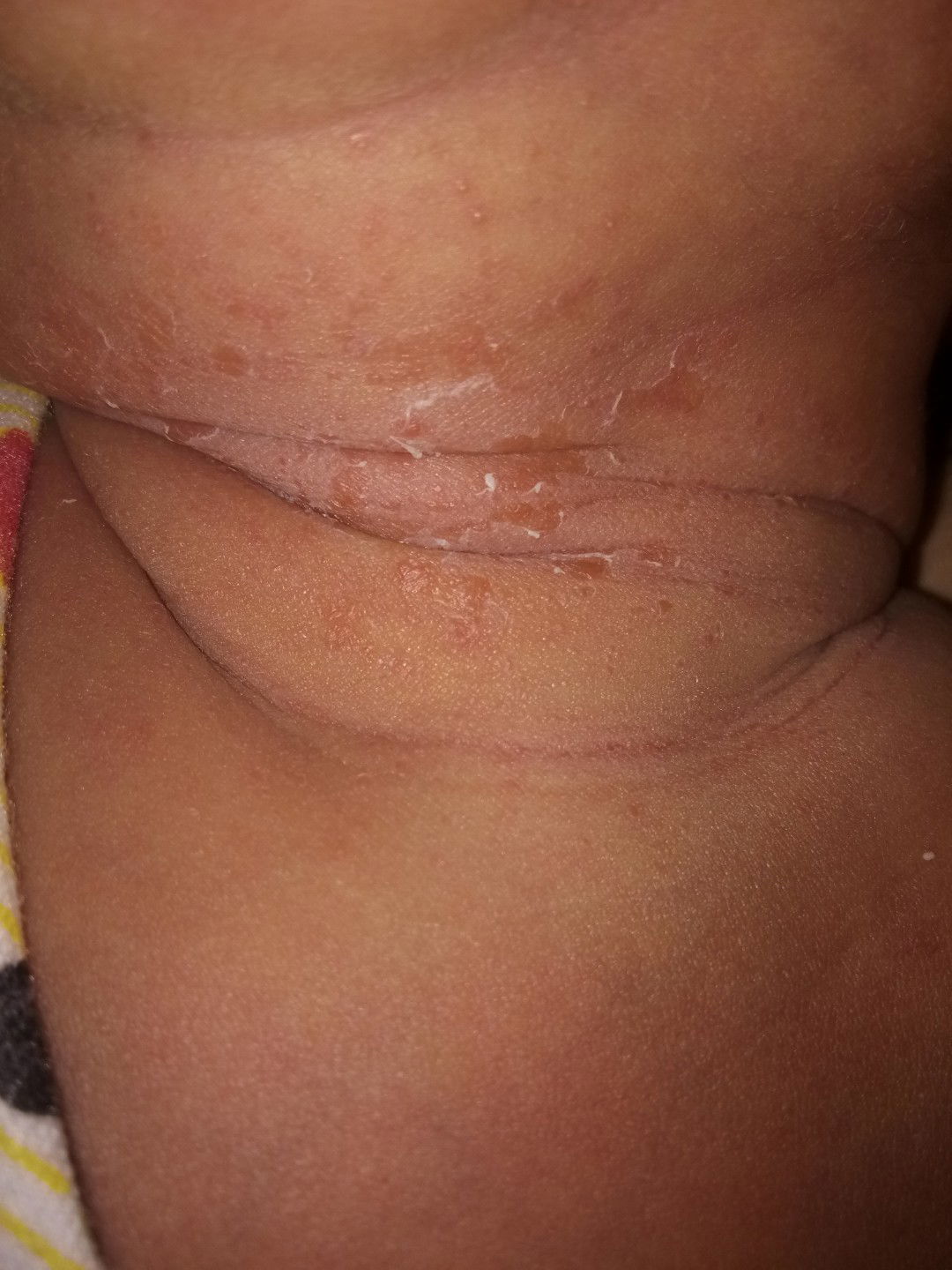 kulit baby belum 2minggu