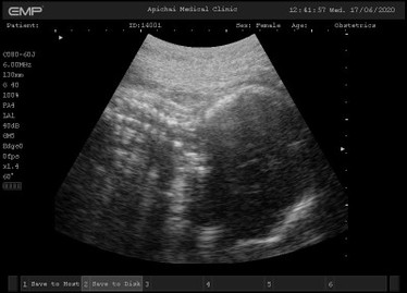 34+2w