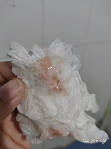 อันตรายไหมคะ