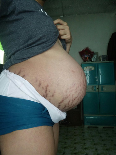 36 weeks po today