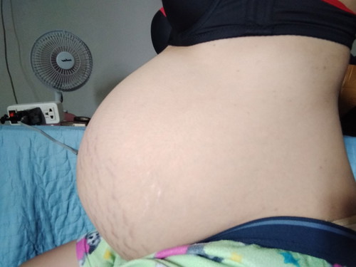 38w5d