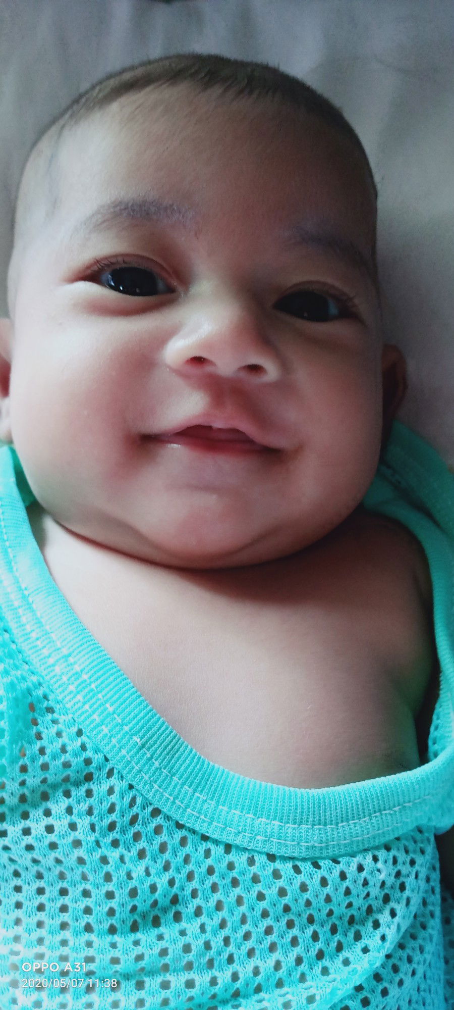 ปวดท้องคลอด