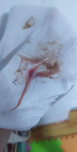 blood stain