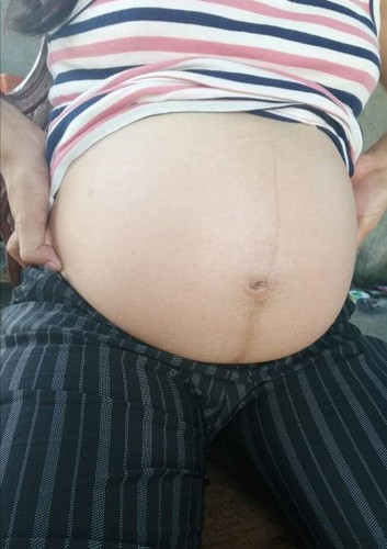 baby bump