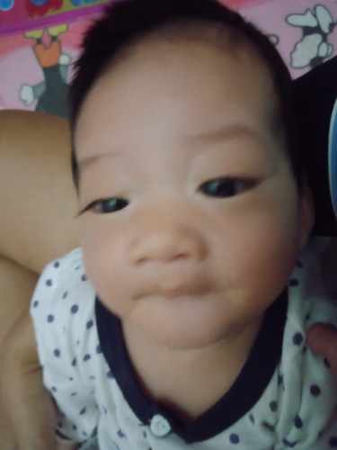 อาการโคลิค