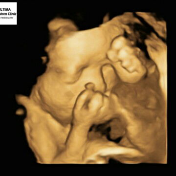 babyq kayaknya pemalu.