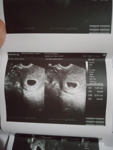 6weeks and 2 days