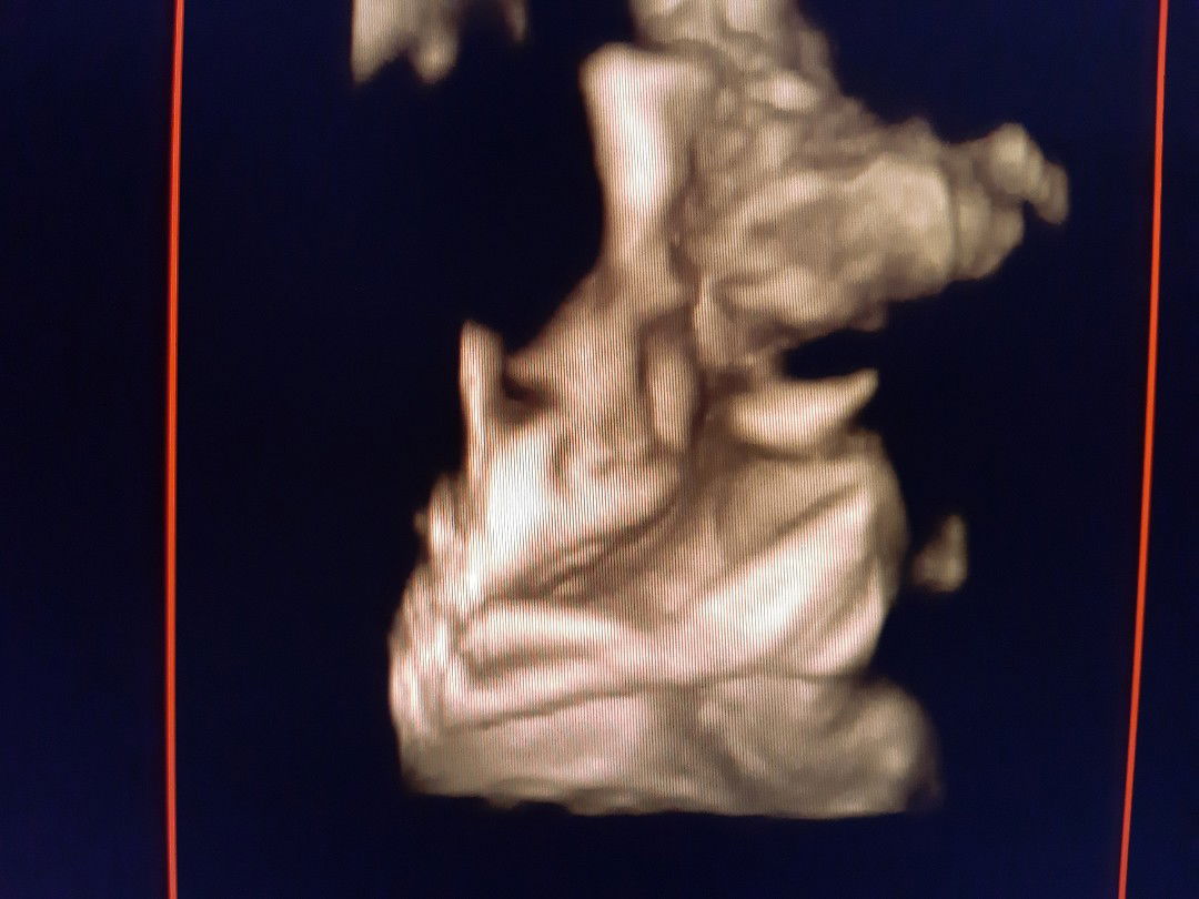 assalamualaikum bunn