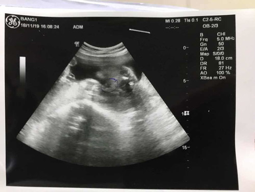 ใครพอดูออกบ้างคะ