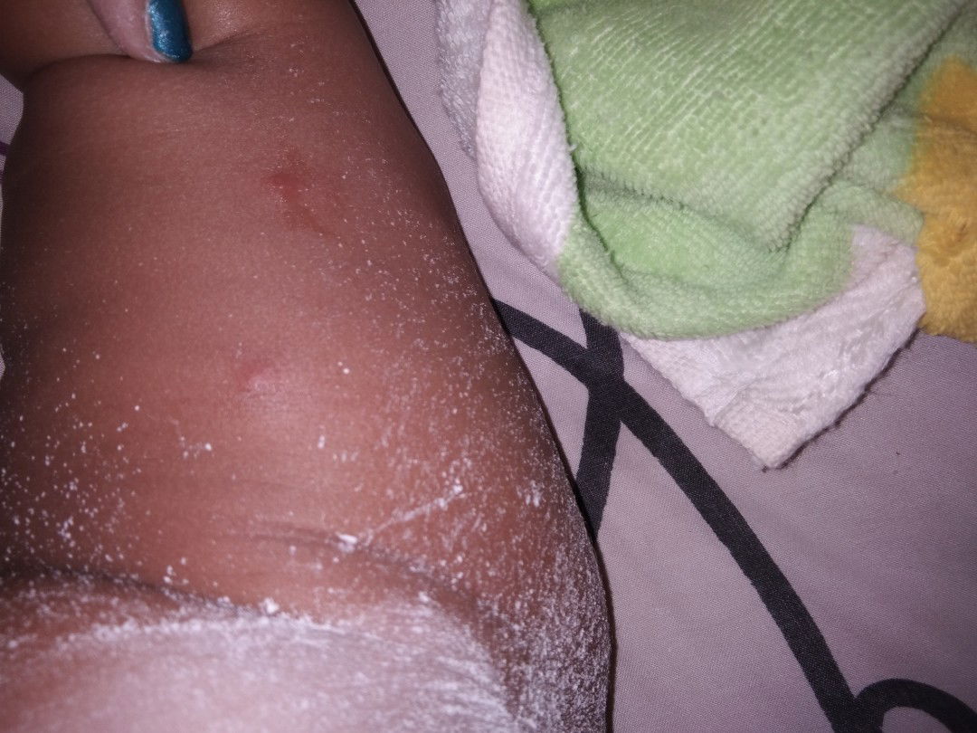 anak saya usia 6bulan