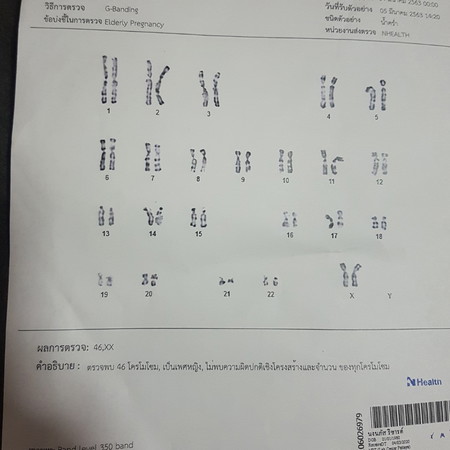 ผลออกมาแล้วหนึ่งเดือนจริงๆกับการรอคอยฟังผล