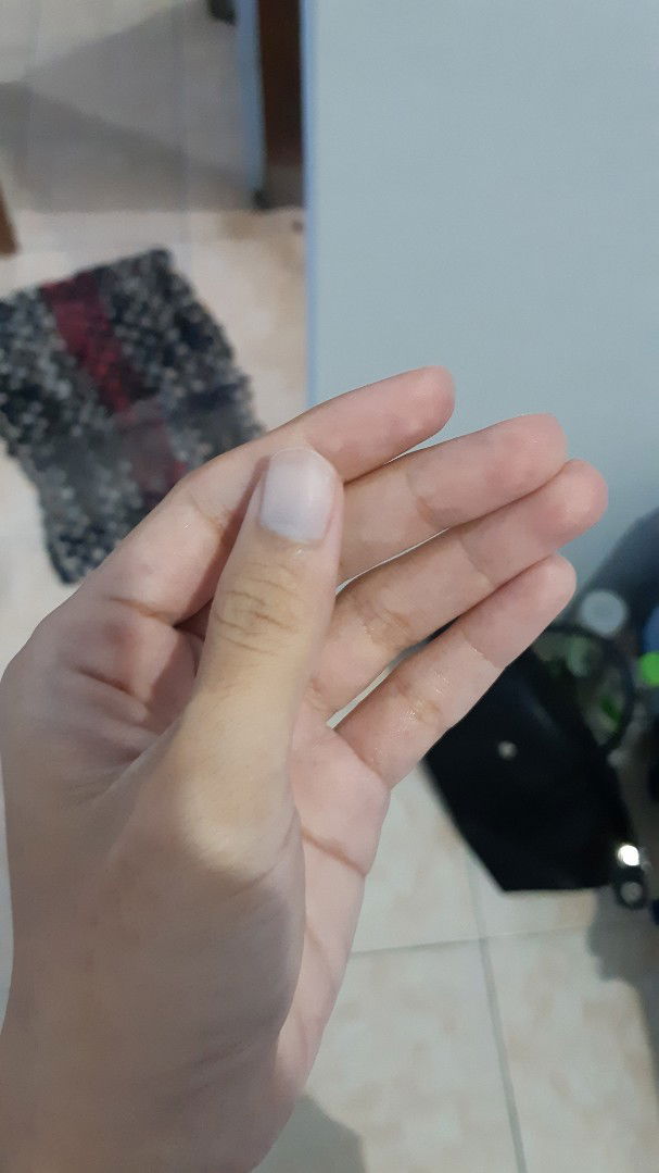 KUKU BIRU di kehanilan TM 1