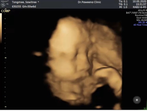 แม่ทีม กค