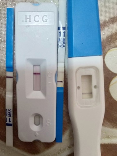 คืออะไรค่ะกังวลมากก