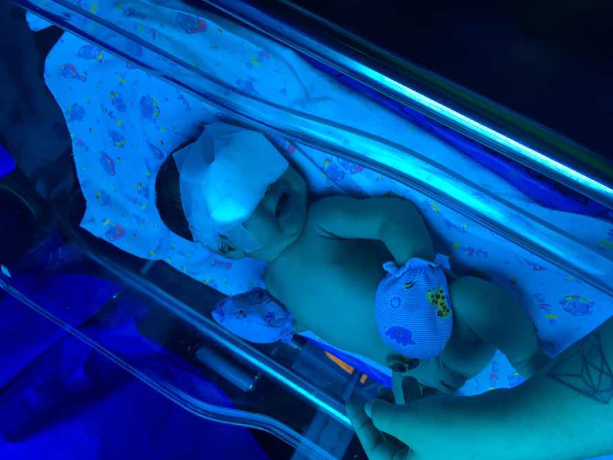 น้องไม่ยอมกินนม เอาเเต่นอน ให้กินเท่าไหร่ก็ไม่ยอมกิน ผลสุดท้ายตัวเหลืองเลยค่ะ