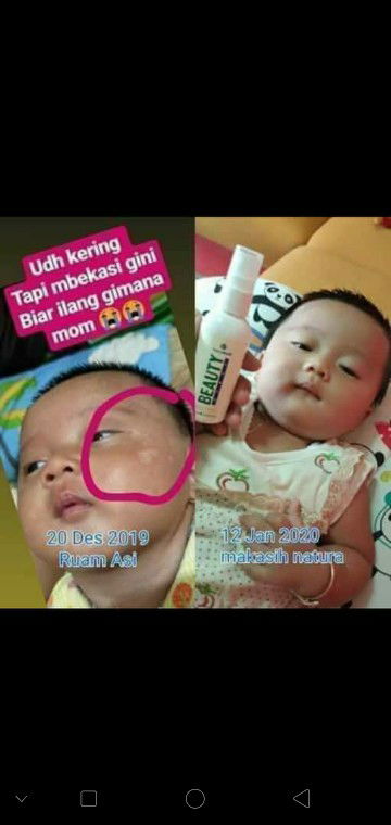 masalah dengan baby