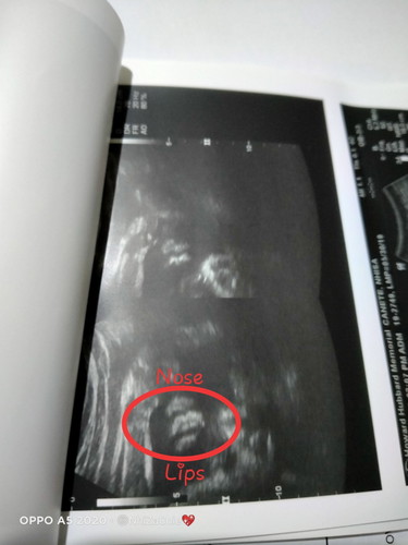 Mas maliit sya sa AOG nya