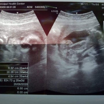 ? บ้านนี้ ลูกสาว ?