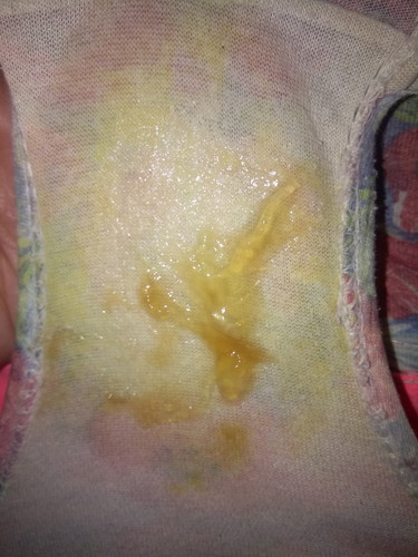 sign naba to na malapit na ako manganak