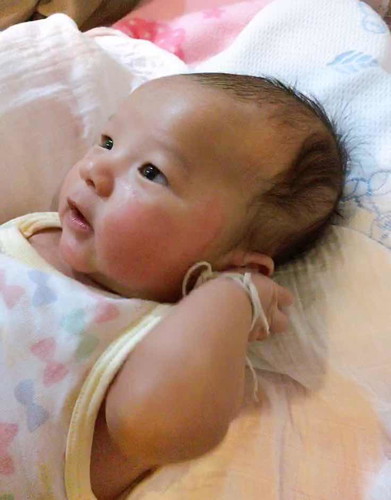 ผื่นแดง คัน ผิวแห้งตึง