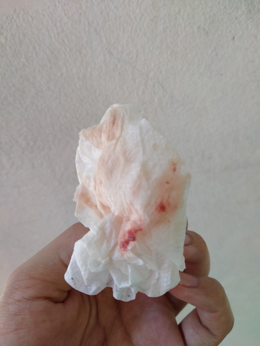 ท้องแรกค่ะ