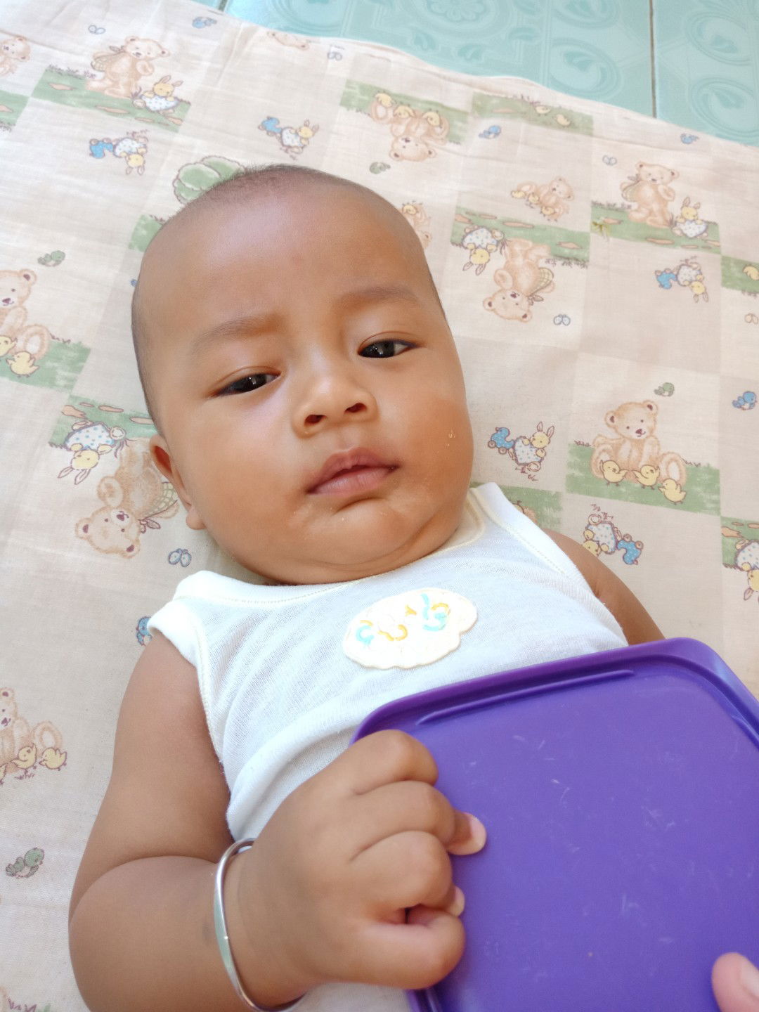 putih putih di wajah bayi