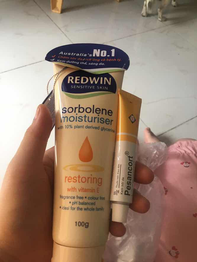 Sẩn ngứa mề đay