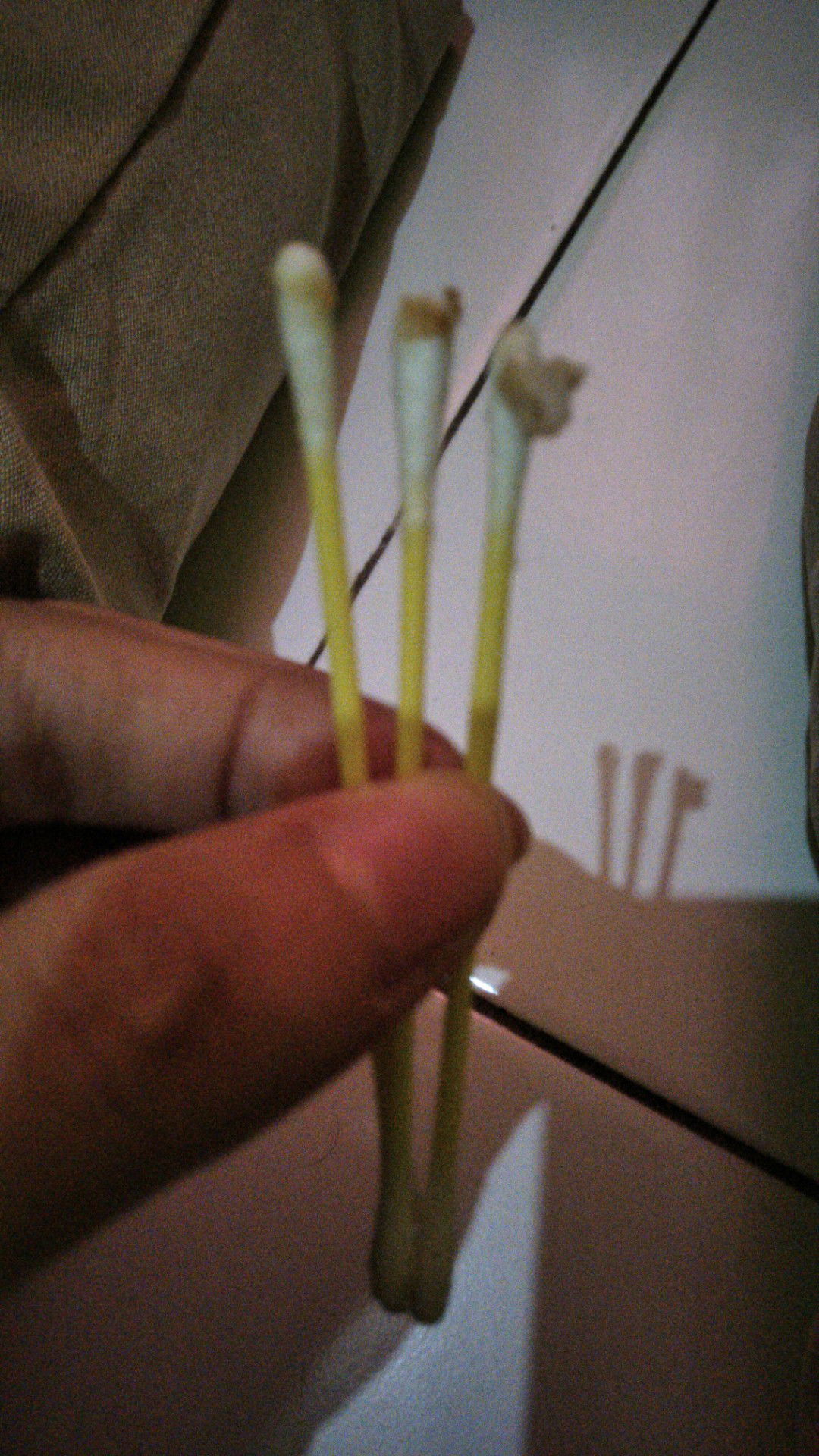 bekas susu di hidung bayi