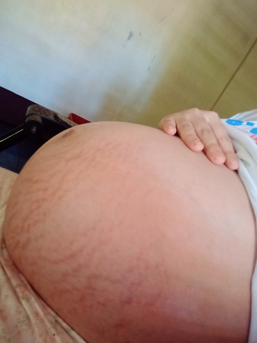 Pregnancy