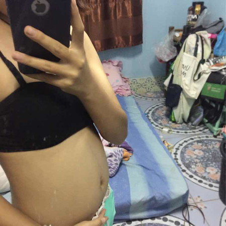 ท้องเล็กไหม